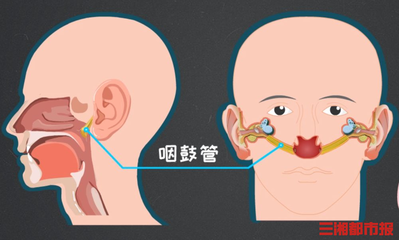 中耳炎会引起咳嗽吗