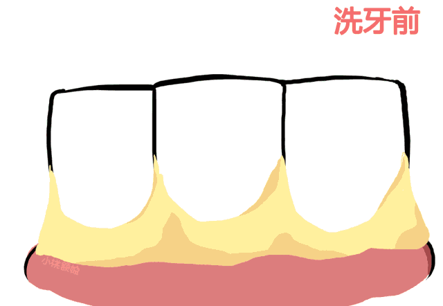 为什么牙齿老是松动
