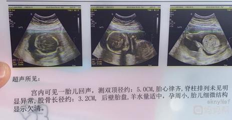 胎儿14周会有胎动吗