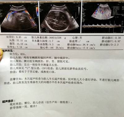多少周估算胎儿体重