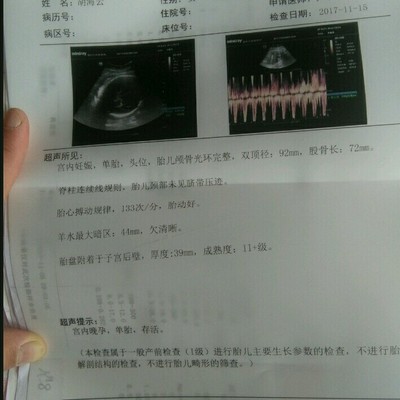 37周后产检多少钱