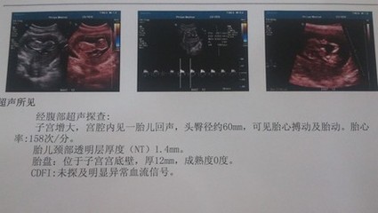 胎儿一般多久有胎心