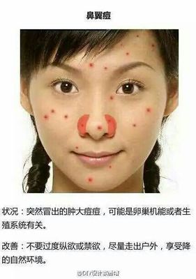 鼻翼冒痘痘