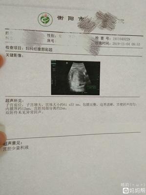 怀孕四十天需要做什么检查