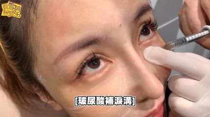 打了玻尿酸痛怎么办