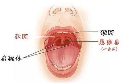 上颚有血丝是怎么回事