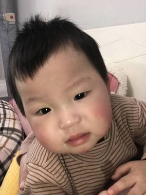 脸发白是怎么回事