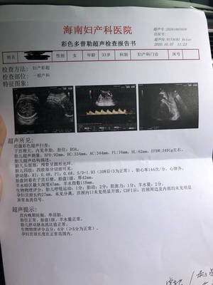 孕36周后胎儿一周一般能长重