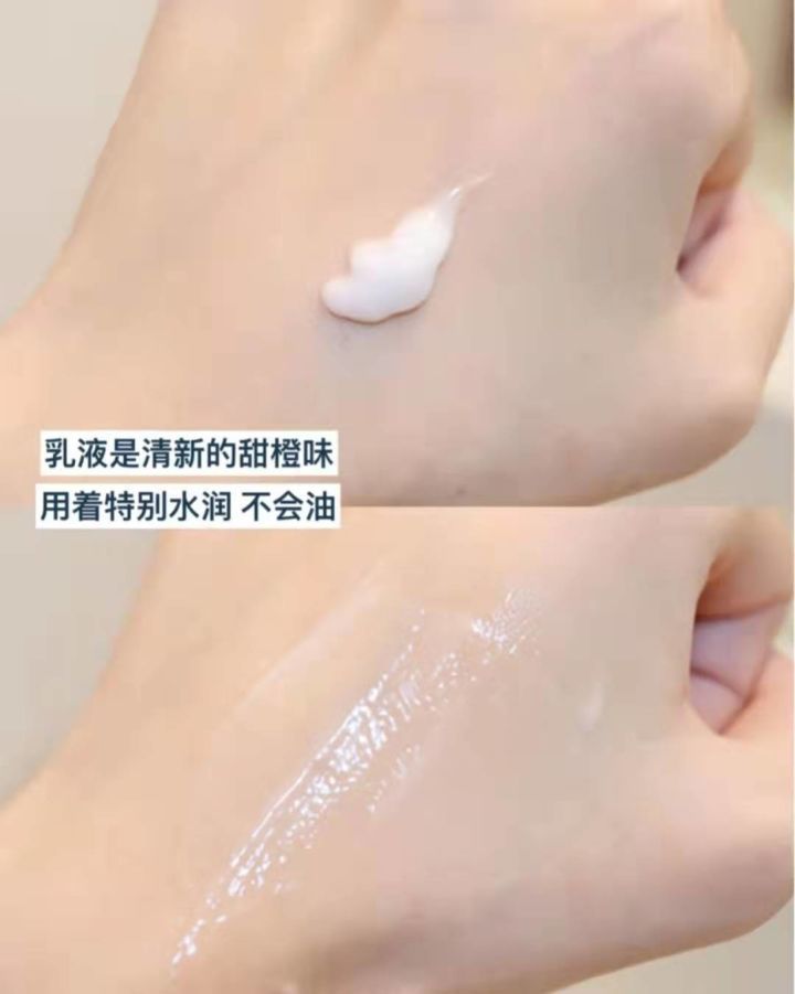 痘痘肌用哪种水乳比较好