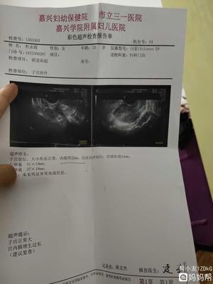 怎么确定是不是怀孕了