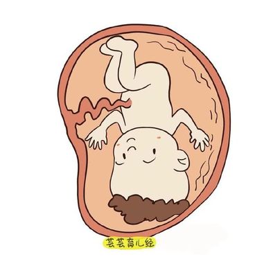 胎儿头小会影响智力吗