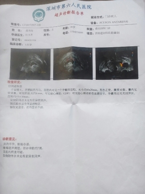 吃孕酮对胎儿有影响吗
