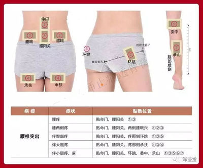 腰眼子疼是怎么回事