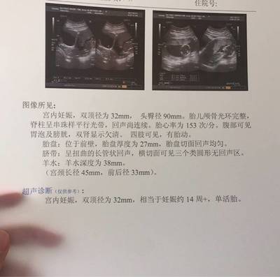 胎儿双顶径标准看男女