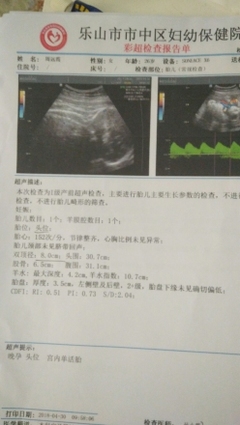 多少周估算胎儿体重
