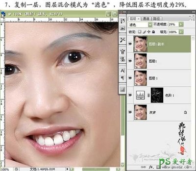 Ps除皱