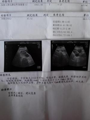 怀孕半个月肚子疼