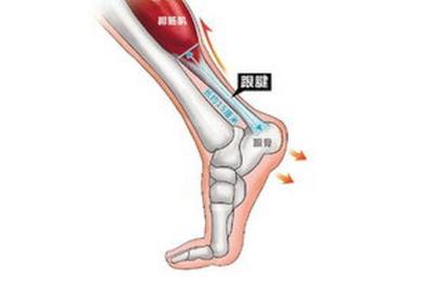 脚跟腱疼痛怎么治疗