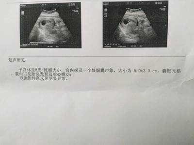 怀孕了怎么看男女