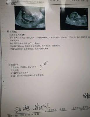 四个月会胎停吗