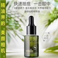 祛痘精油配方