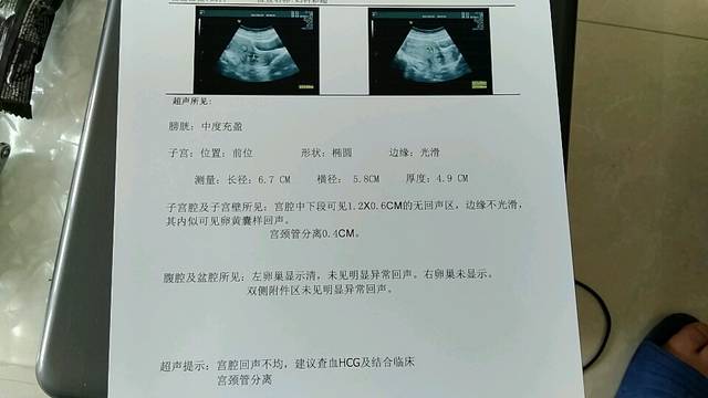 怀孕50天做什么检查