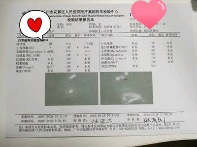 白带淡粉色是怎么回事