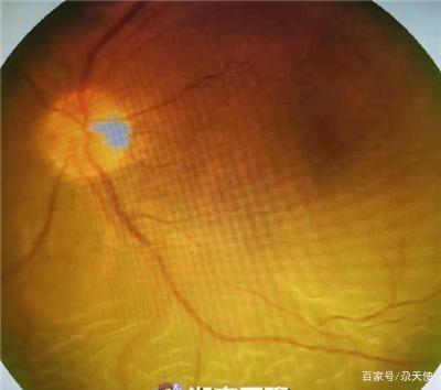 眼睛0.02多少伤级