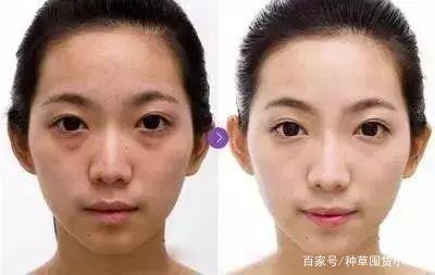 童颜针和水光针的区别