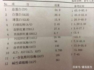 小儿黄疸值正常是多少正常
