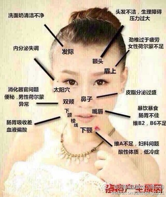 痘痘的相关知识文章