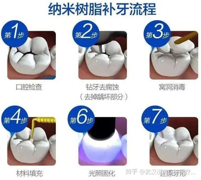 补牙价格