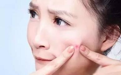 挤了痘痘之后可以洗脸吗