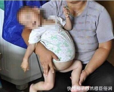 两岁宝宝肚子疼