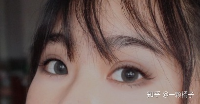 怎样才有双眼皮