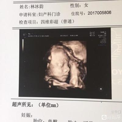 胎儿胎位什么时候固定