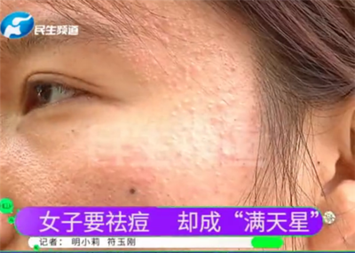 郑州 痘痘