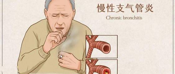 支气管炎哮喘怎么治疗才能除根