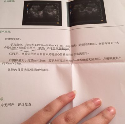 围排卵期是什么意思