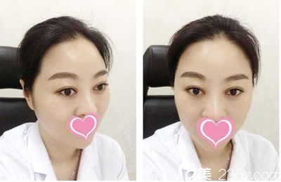 哪里有学做双眼皮的