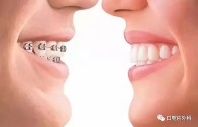口腔黏膜病怎么治疗