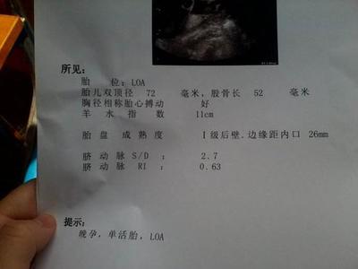 怀孕多久可以鉴定男女