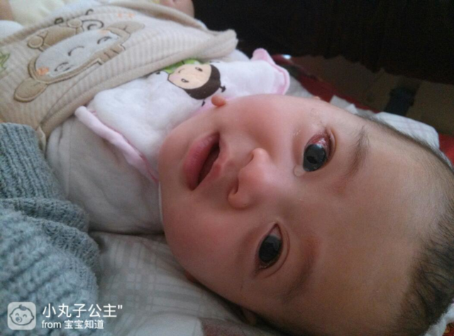 婴儿眼皮肿是怎么回事