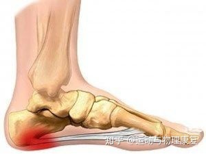脚底板中间疼是怎么回事