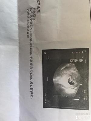 孕妇吃什么可以补孕酮
