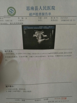 怀孕40天孩子多大