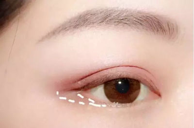 贴双眼皮贴