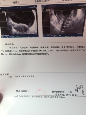 卵泡多大容易怀孕