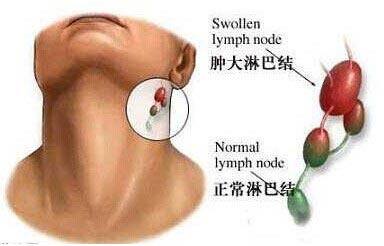 左右甲状腺正常厚约多少钱