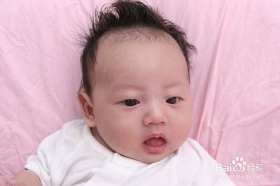 新生儿胎发一定要剃吗